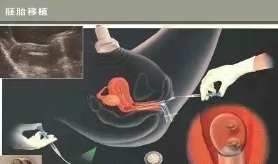 关于明远生殖医学中心